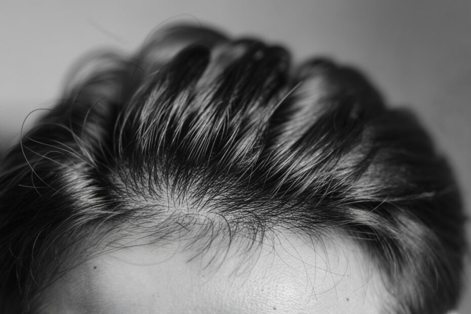 How to Improve Scalp Health
