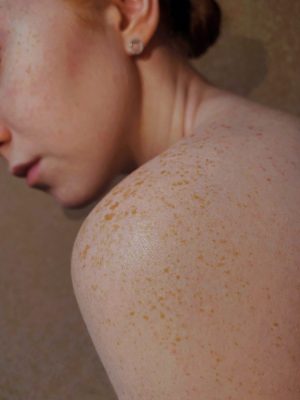 Healthy Skin